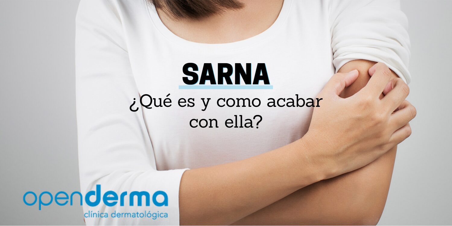 sarna que es openderma murcia