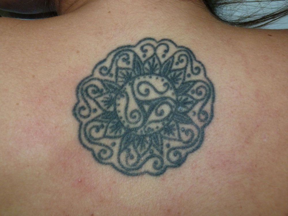 Tatuaje openderma murcia