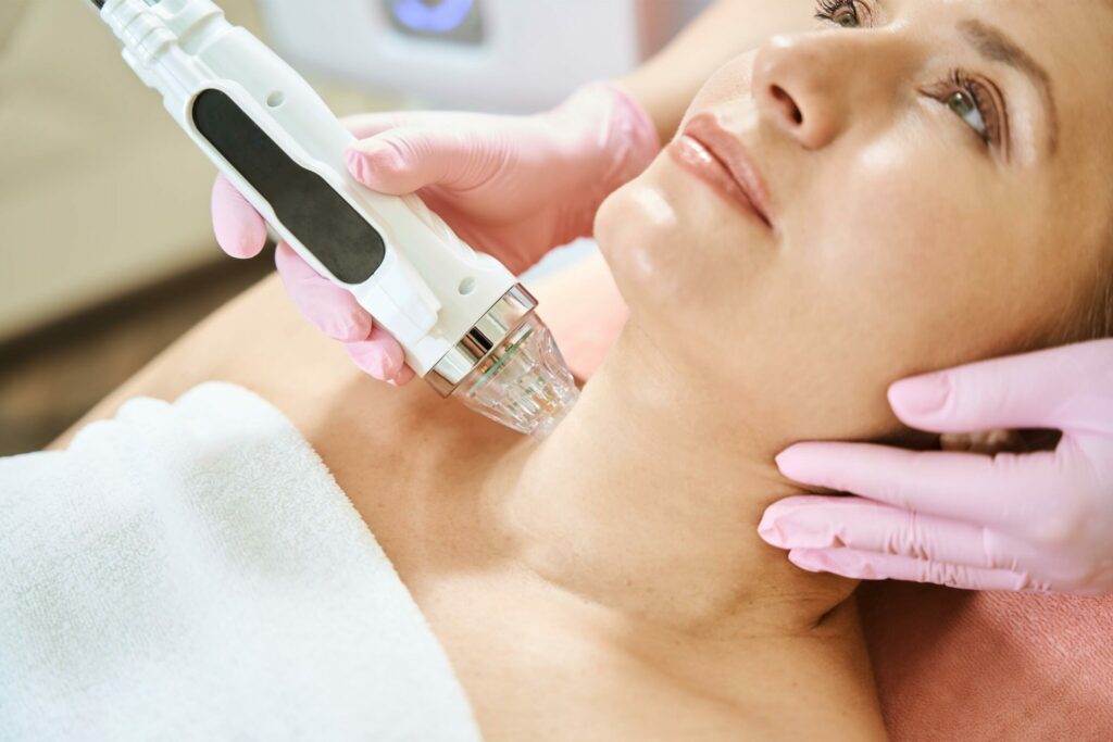 openderma laser vascular