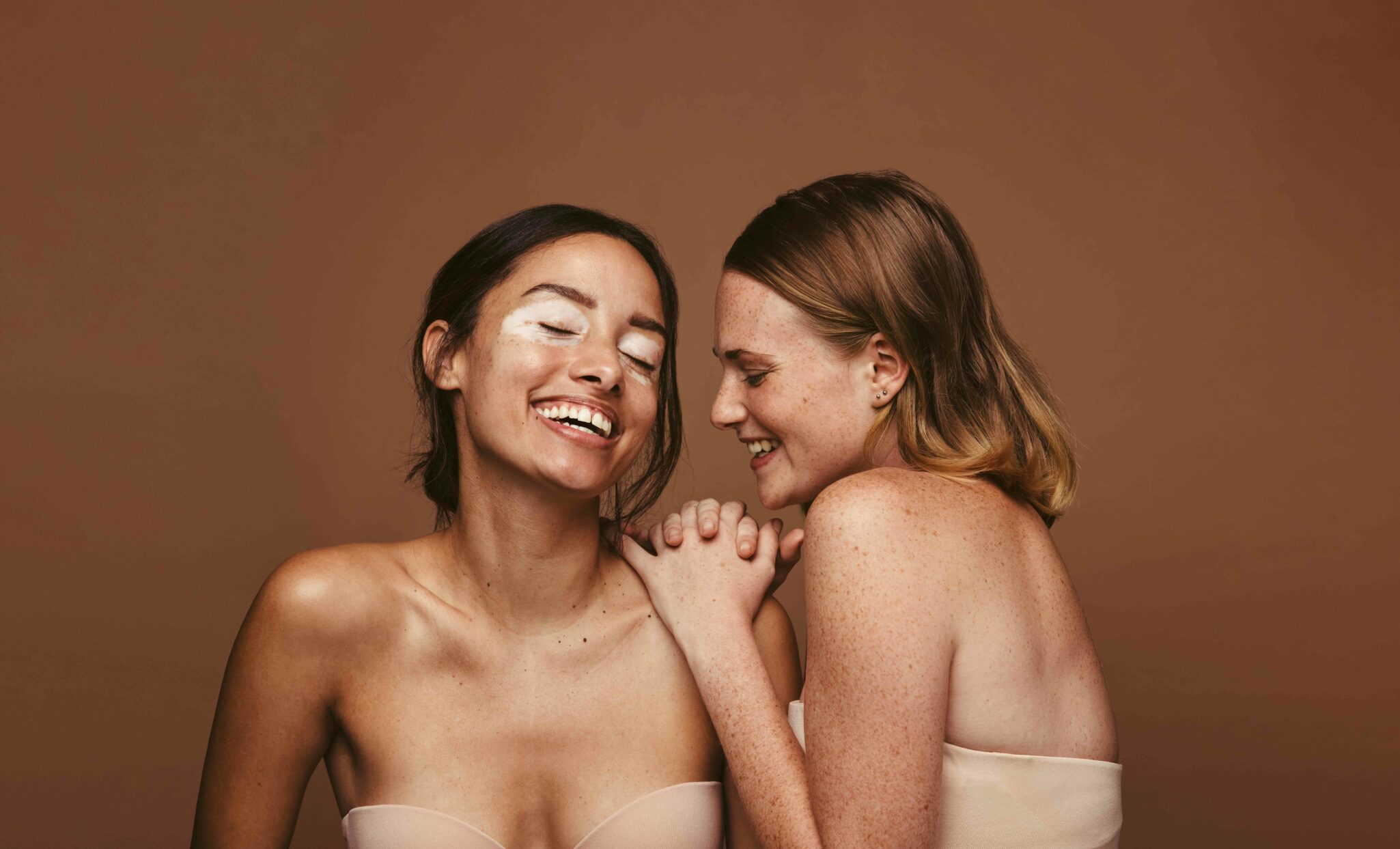 Two young women with skin condition standing together on brown background. Woman with diverse skin accepting their natural beauty.